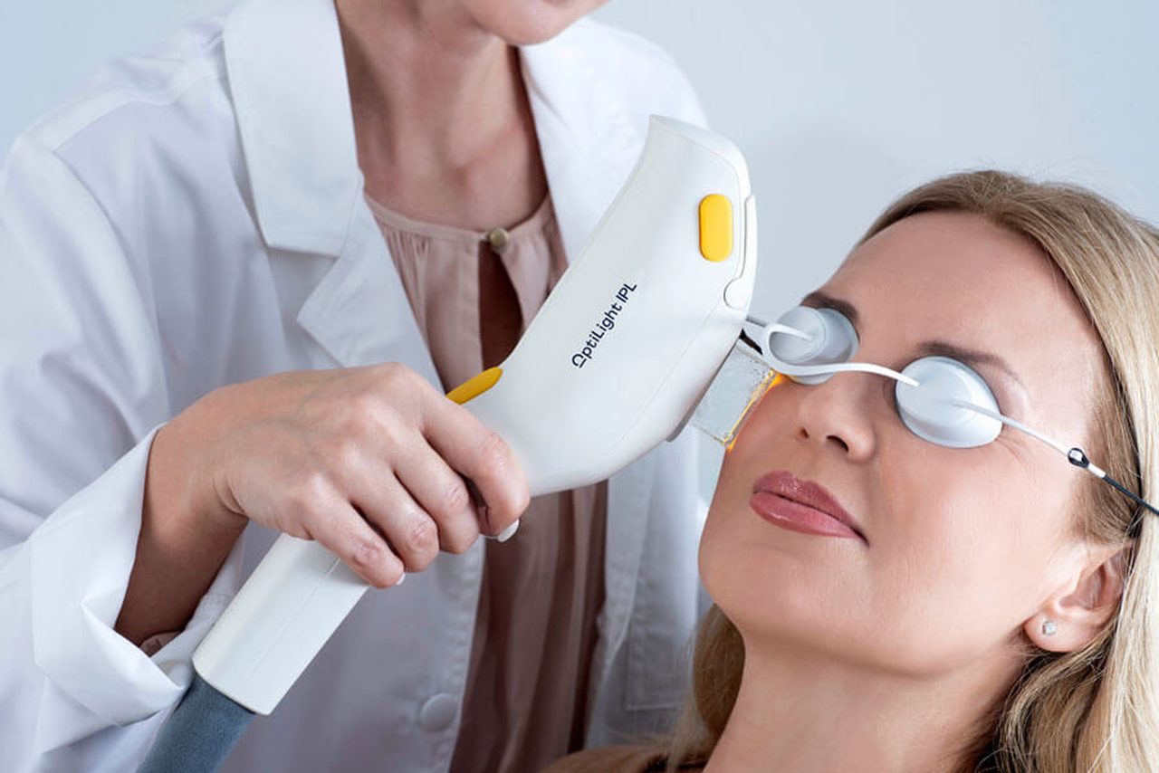 IPL dry eye treatment — doctor performing in-office therapy on patient