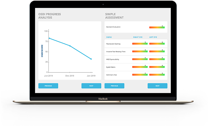 CSI Dry Eye Software