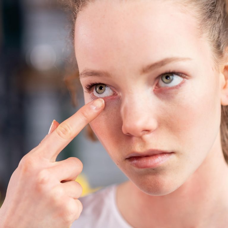 Dry Eye Symptoms Sensitivity to Light Bloodshot Eyes CSI Dry Eye