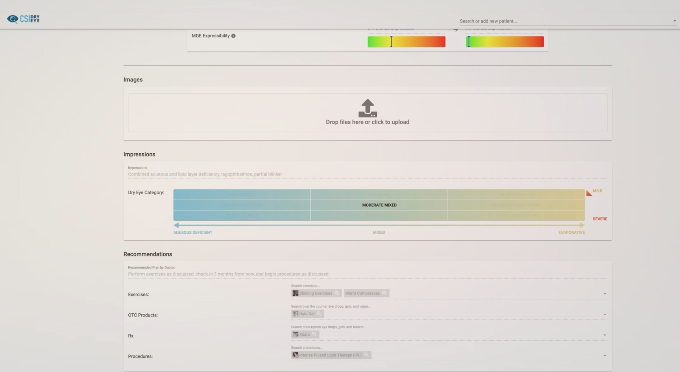 CSI Dry Eye Software